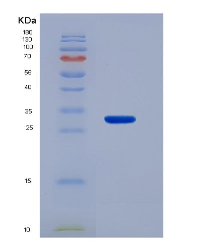 Human ACAA1 (3-Ketoacyl-Coa Thiolase, Peroxisomal) - Recombinant Protein