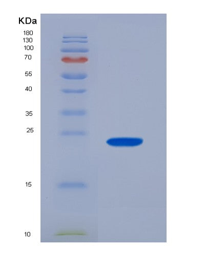 Human SNRPC (U1 Small Nuclear Ribonucleoprotein C) - Recombinant Protein
