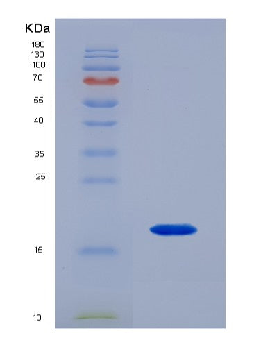 Human RBP1 (Retinol-Binding Protein 1) - Recombinant Protein