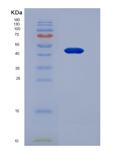 Human PAEP (Glycodelin) - Recombinant Protein