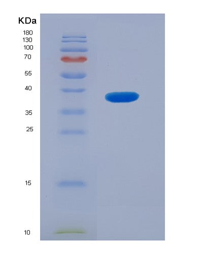 Human CLTB (Clathrin Light Chain B) - Recombinant Protein