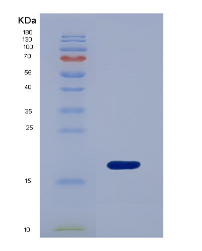 Human ANXA4 (Annexin A4) - Recombinant Protein