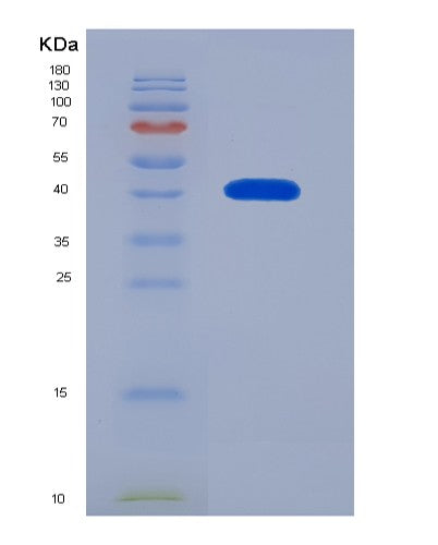 Human HNRNPA1 (Heterogeneous Nuclear Ribonucleoprotein A1) - Recombinant Protein