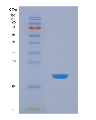 Human GIP (Gastric Inhibitory Polypeptide) - Recombinant Protein