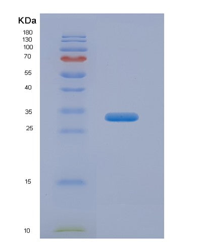 Human TACSTD2 (Tumor-Associated Calcium Signal Transducer 2) - Recombinant Protein