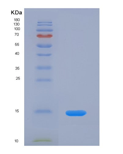 Human FURIN (Furin) - Recombinant Protein