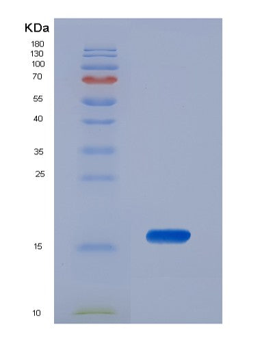 Human TRAPPC2 (Trafficking Protein Particle Complex Subunit 2) - Recombinant Protein