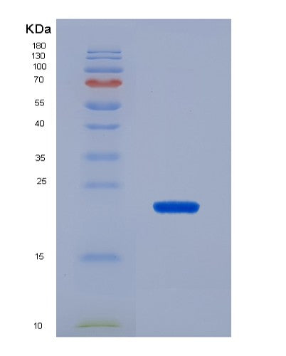 Human SRGN (Serglycin) - Recombinant Protein