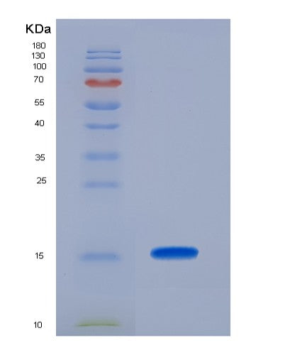 Human RARA (Retinoic Acid Receptor Alpha) - Recombinant Protein