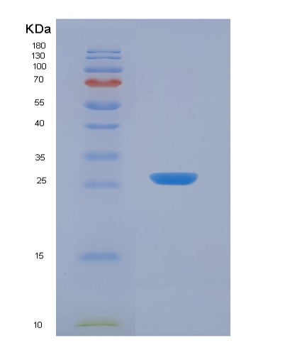 Human KIT (Mast/Stem Cell Growth Factor Receptor Kit) - Recombinant Protein