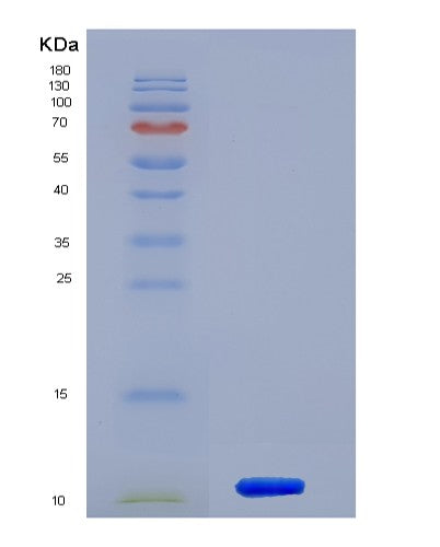 Human HSPA8 (Heat Shock Cognate 71 Kda Protein) - Recombinant Protein