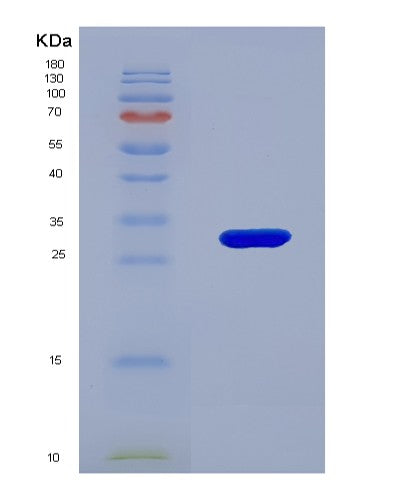 Human ACADM (Medium-Chain Specific Acyl-Coa Dehydrogenase, Mitochondrial) - Recombinant Protein