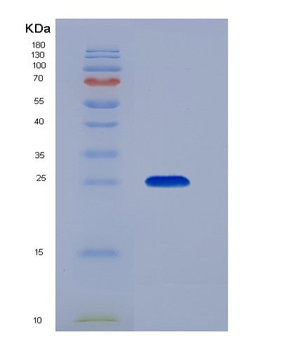 Human PSG1 (Pregnancy-Specific Beta-1-Glycoprotein 1) - Recombinant Protein