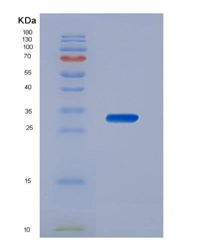 Human CDK4 (Cyclin-Dependent Kinase 4) - Recombinant Protein