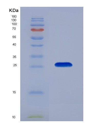 Human ODC1 (Ornithine Decarboxylase) - Recombinant Protein