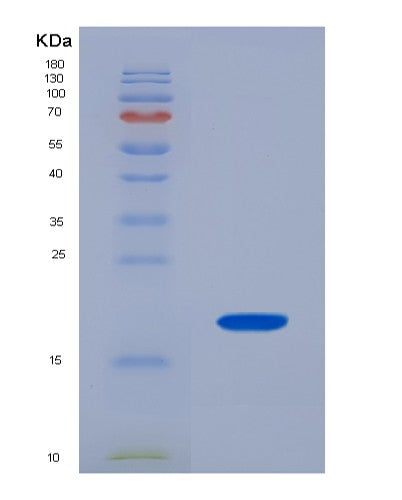 Human FABP2 (Fatty Acid-Binding Protein, Intestinal) - Recombinant Protein