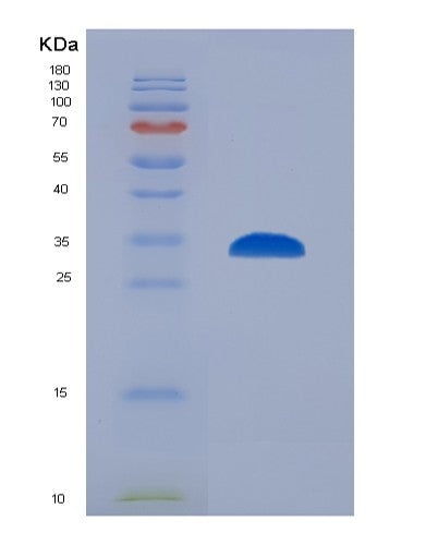 Human IMPDH2 (Inosine-5'-Monophosphate Dehydrogenase 2) - Recombinant Protein