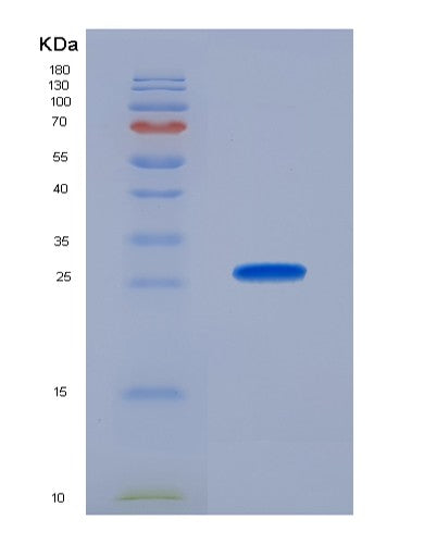 Human PTHLH (Parathyroid Hormone-Related Protein) - Recombinant Protein