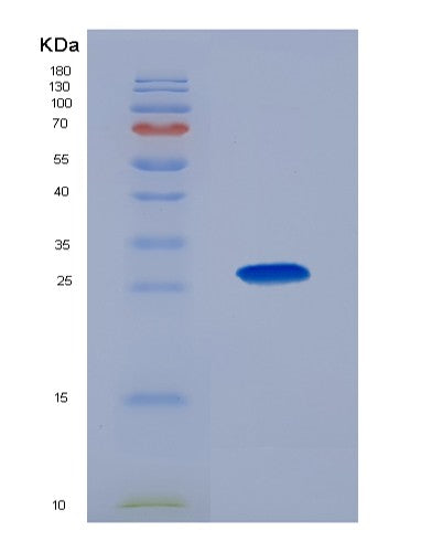 Human CKMT1A (Creatine Kinase U-Type, Mitochondrial) - Recombinant Protein