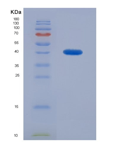 Human BMP2 (Bone Morphogenetic Protein 2) - Recombinant Protein