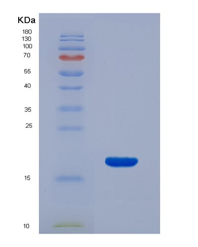 Human RNASE3 (Eosinophil Cationic Protein) - Recombinant Protein