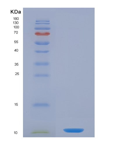Human CCL5 (C-C Motif Chemokine 5) - Recombinant Protein