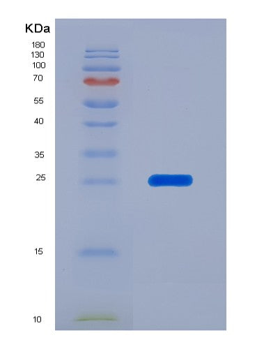 Human EEF2 (Elongation Factor 2) - Recombinant Protein