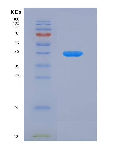Human KRT5 (Keratin, Type Ii Cytoskeletal 5) - Recombinant Protein