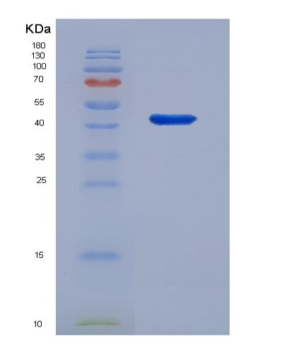 Human ENO3 (Beta-Enolase) - Recombinant Protein