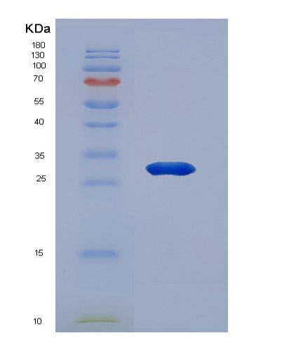 Human HSD17B1 (17-Beta-Hydroxysteroid Dehydrogenase Type 1) - Recombinant Protein