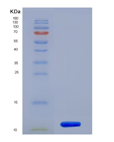Mouse S100a6 (Protein S100-A6) - Recombinant Protein