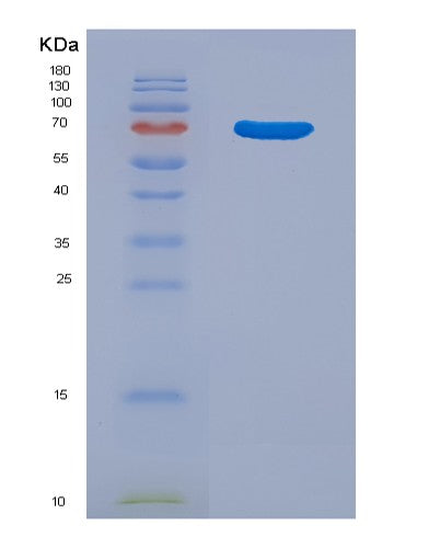 Human CTSE (Cathepsin E) - Recombinant Protein