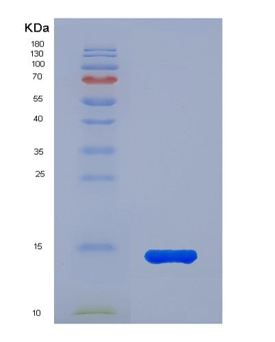 Human MIF (Macrophage Migration Inhibitory Factor) - Recombinant Protein