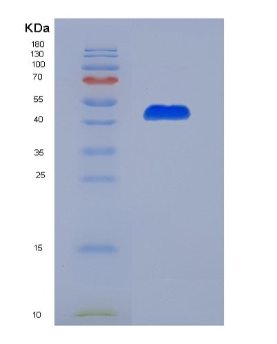 Human IRF2 (Interferon Regulatory Factor 2) - Recombinant Protein