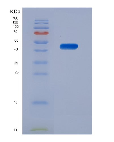 Human NCF1 (Neutrophil Cytosol Factor 1) - Recombinant Protein