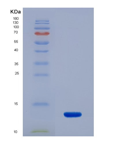Human PKM (Pyruvate Kinase Pkm) - Recombinant Protein