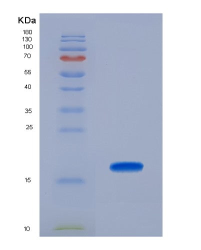 Human DARS1 (Aspartate--Trna Ligase, Cytoplasmic) - Recombinant Protein