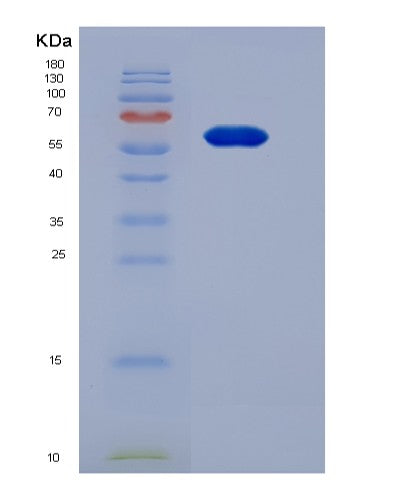 Human VAV1 (Proto-Oncogene Vav) - Recombinant Protein