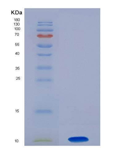 Human CSF2RA (Granulocyte-Macrophage Colony-Stimulating Factor Receptor Subunit Alpha) - Recombinant Protein