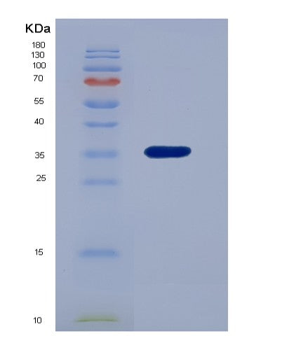 Human HTN3 (Histatin-3) - Recombinant Protein