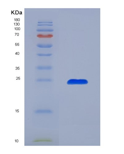 Human IGLL1 (Immunoglobulin Lambda-Like Polypeptide 1) - Recombinant Protein