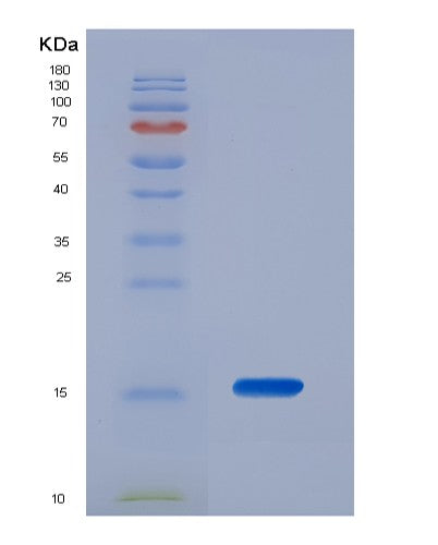 Mouse Lgals1 (Galectin-1) - Recombinant Protein