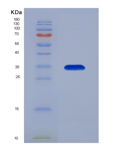 Human CBR1 (Carbonyl Reductase [Nadph] 1) - Recombinant Protein