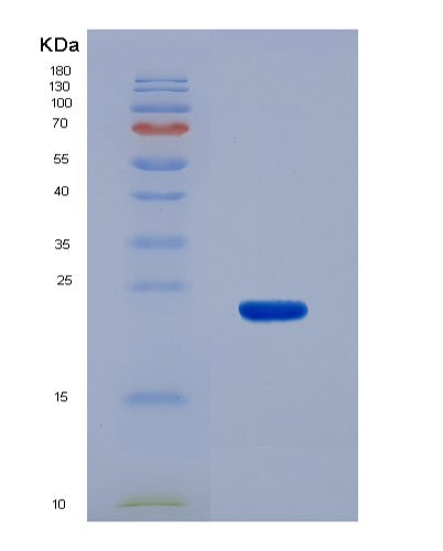 Human ACADS (Short-Chain Specific Acyl-Coa Dehydrogenase, Mitochondrial) - Recombinant Protein