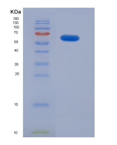 Human EPCAM (Epithelial Cell Adhesion Molecule) - Recombinant Protein
