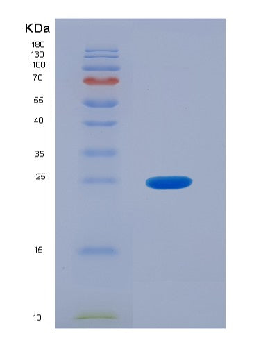 Human MGMT (Methylated-Dna--Protein-Cysteine Methyltransferase) - Recombinant Protein