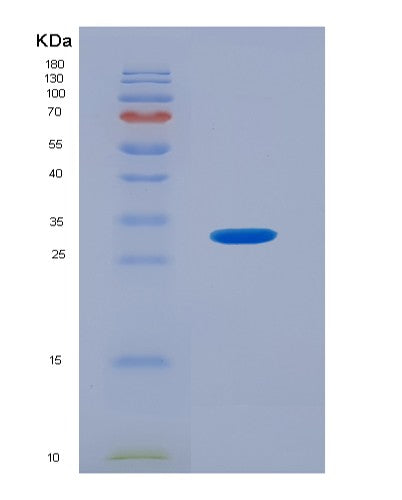 Human GNB3 (Guanine Nucleotide-Binding Protein G(I)/G(S)/G(T) Subunit Beta-3) - Recombinant Protein