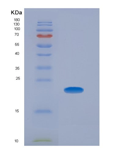 Human CPE (Carboxypeptidase E) - Recombinant Protein