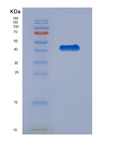 Human HSPA6 (Heat Shock 70 Kda Protein 6) - Recombinant Protein