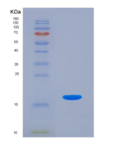 Human HMGA1 (High Mobility Group Protein Hmg-I/Hmg-Y) - Recombinant Protein